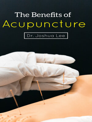 cover image of The Benefits of Acupuncture for Health and Wellness